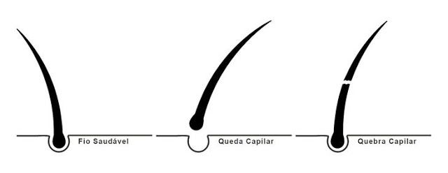 Quebra ou queda de cabelo?